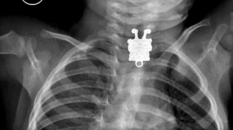 Η ακτινογραφία αποκάλυψε τον.. Μπομπ Σφουγγαράκη!