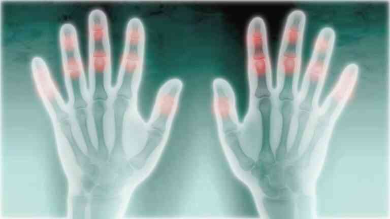 Τι συμβαίνει όταν κάνετε “κρακ” στα δάχτυλα