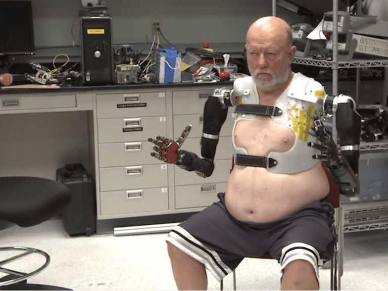 Τεχνητά μέλη κινούνται μόνο με τη σκέψη